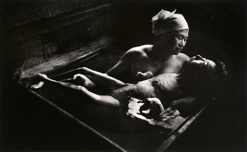 Tomoko Being Bathed by Her Mother, Minamata, Japan