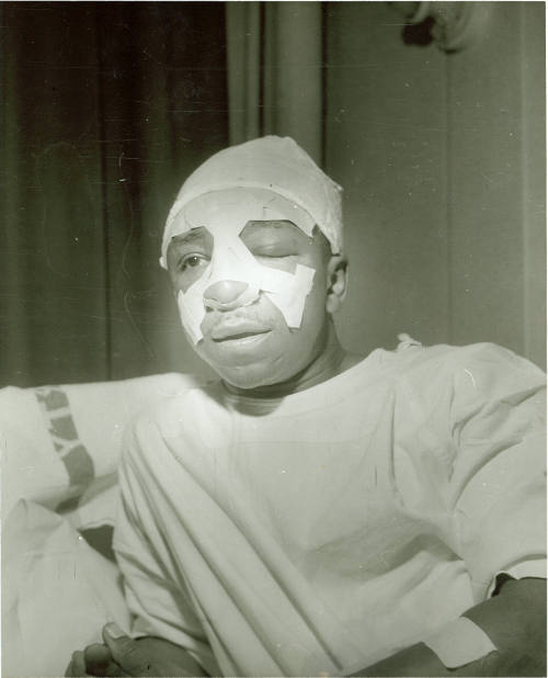 Robert (Honey Boy) Thomas: After the Attack