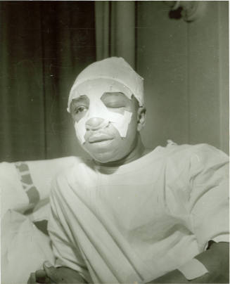 Robert (Honey Boy) Thomas: After the Attack