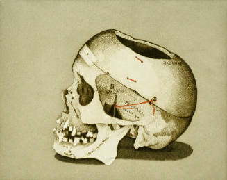 Dr. R's Skull