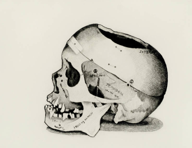 Dr. R's Skull